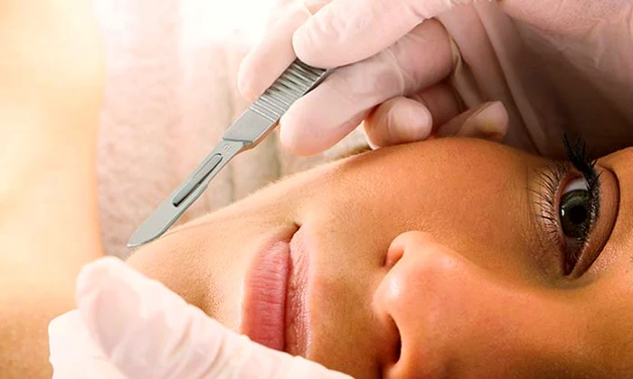1, 2, or 3 x Dermaplaning Sessions at The Beaute Loft