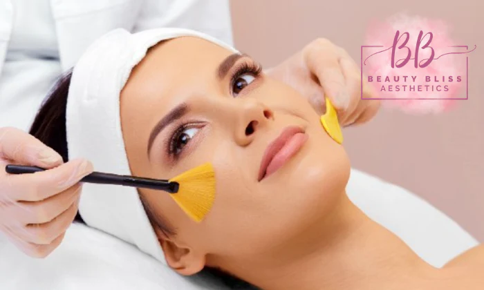 1, 3, or 5 x Chemical Peels at Beauty Bliss - Aesthetics