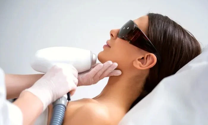 3 x IPL Hair Removal Sessions at Laser Clinic Medical - Image 2