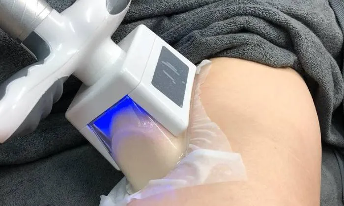 Cryolipolysis Treatment Including Ultrasonic Cavitation and Radio Frequency Treatment from La Glace Beauty Clinic - Image 3
