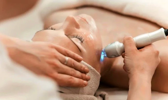 Microneedling Sessions at In Your Skin Wellness & Beauty Lab - Image 2