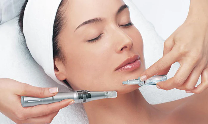 Microneedling Sessions at The Beaute Loft