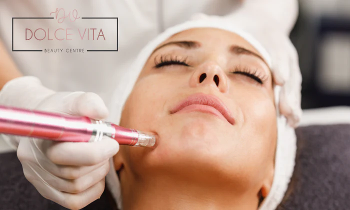 Six Aesthetics Collagen Induction Microneedling