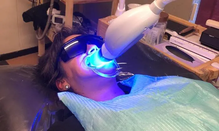 Teeth Whitening Session from La Glace Beauty Clinic - Image 5
